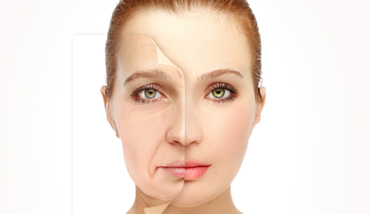 Face Lift Surgery