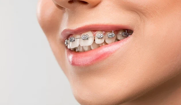 Dental Health