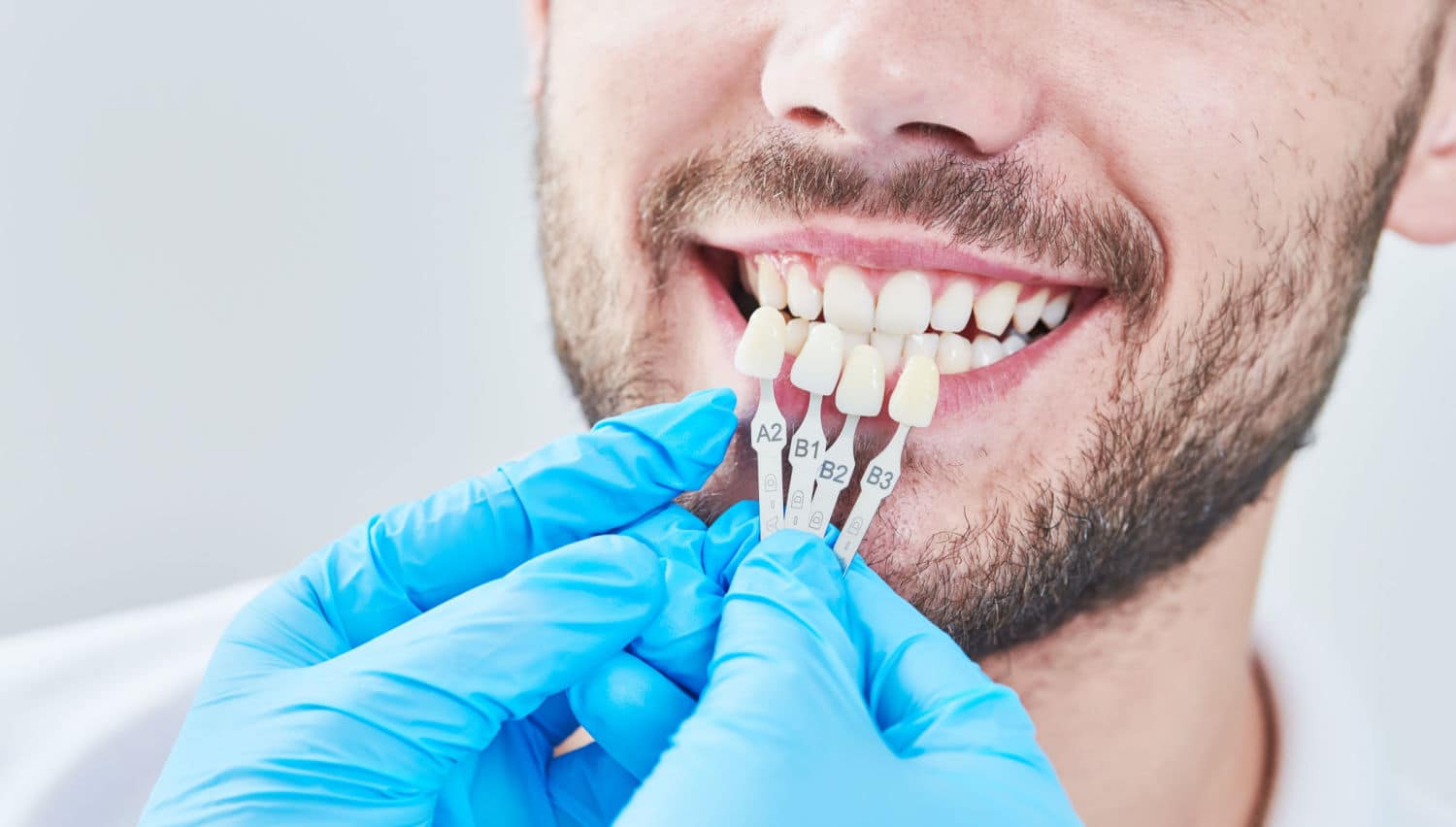 Aesthetic Dentistry