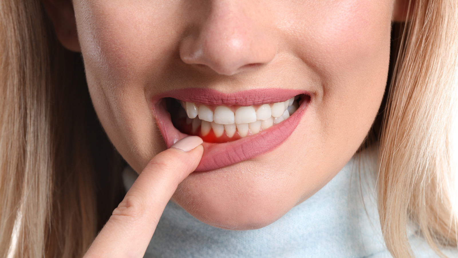 Gum Diseases - Periodontology