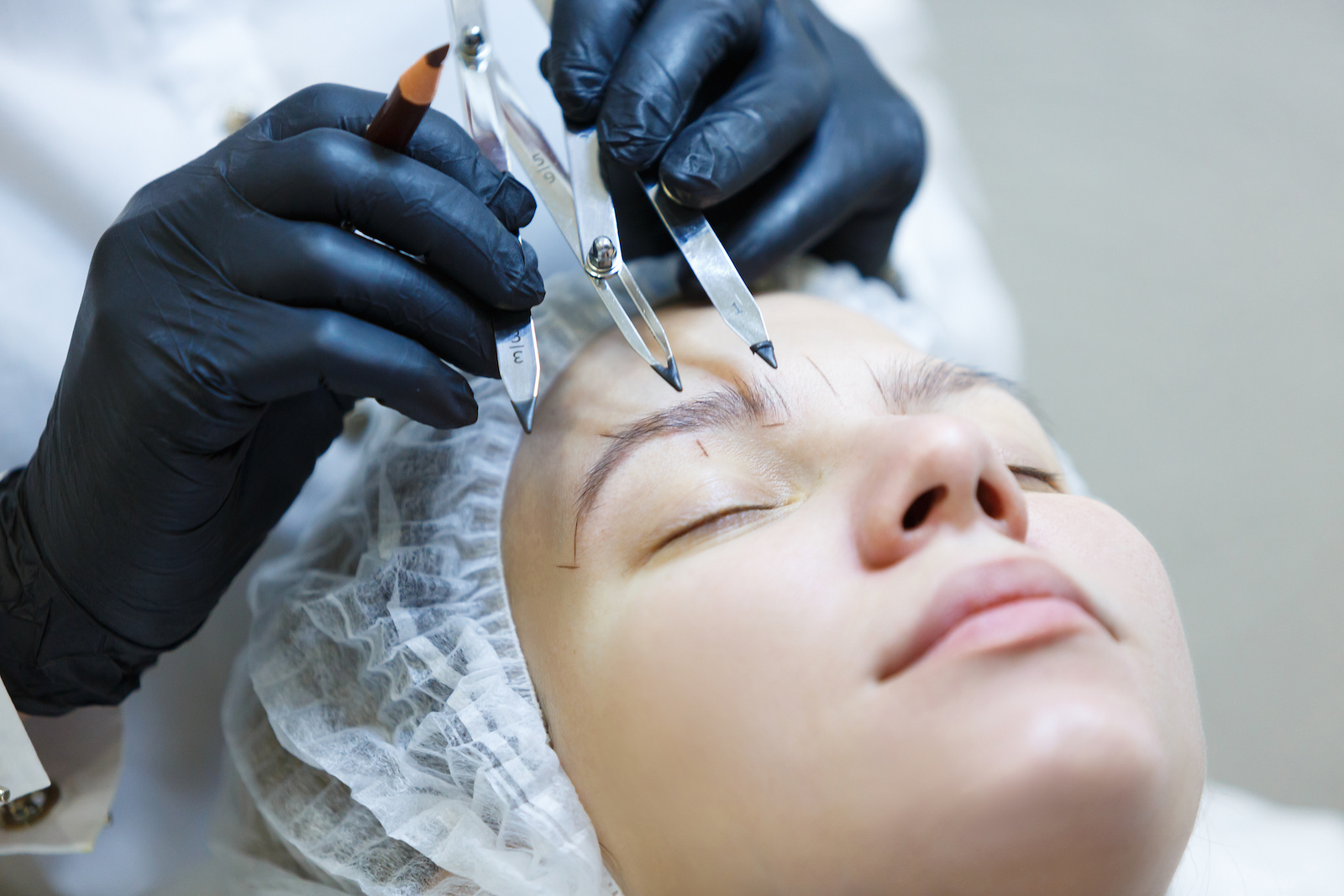 Eyebrow Transplantation